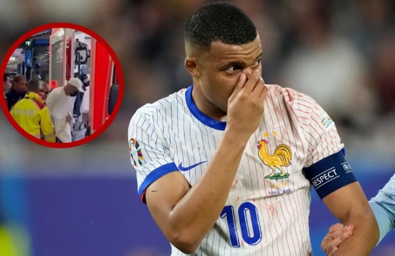 Developments in Mbappe’s in.jury and the expected duration of his absence after nose surgery