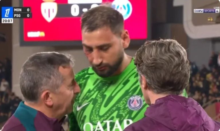 Watch the severe injury suffered by Paris Saint-Germain goalkeeper Donnarumma against Monaco in the French League